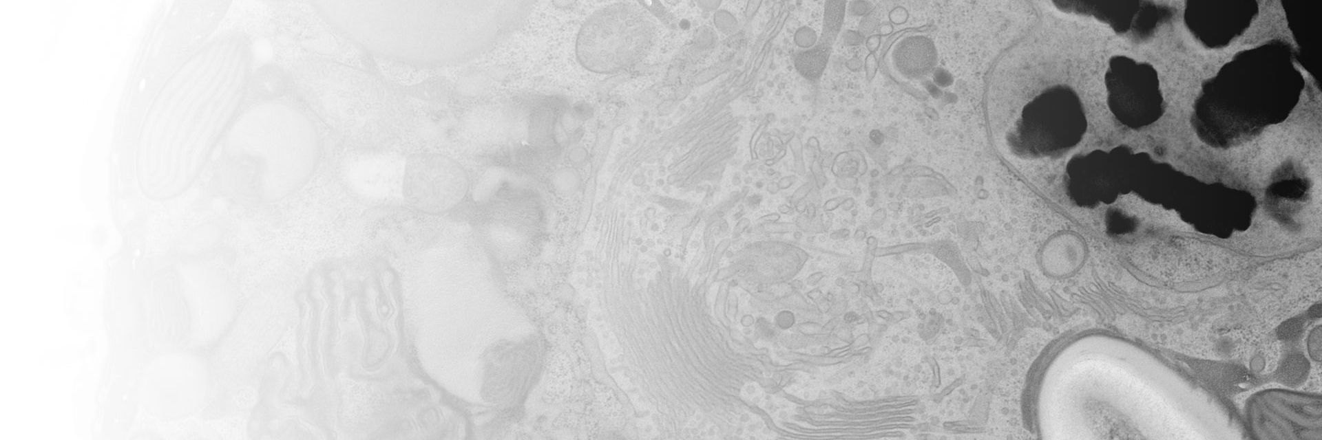 Micrograph of a dinoflagellate cell. In preparation for EM imaging the sample underwent high-pressure freezing, freeze substitution, and ultramicrotomy. 