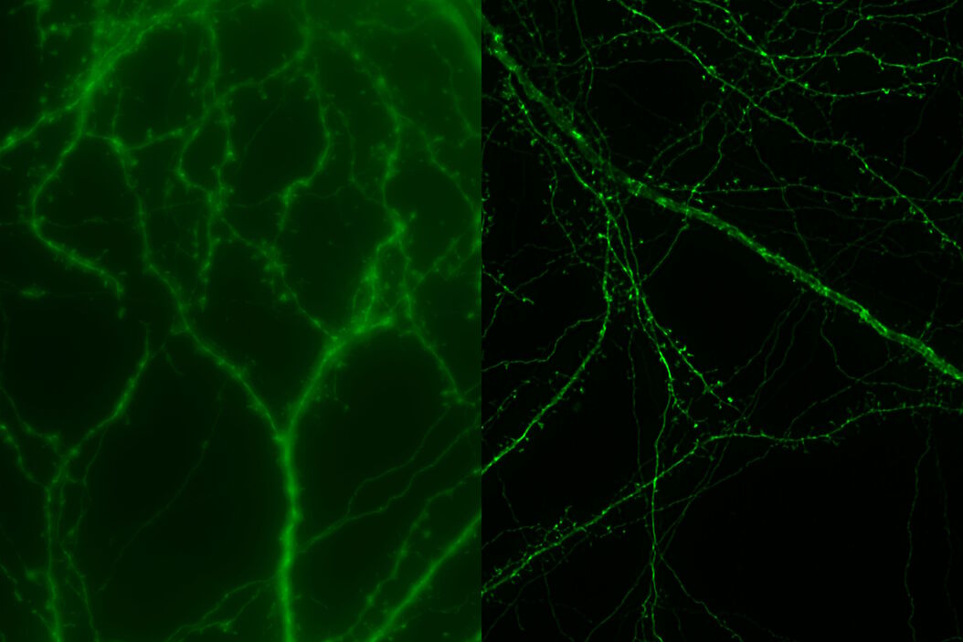 マウス皮質ニューロン（GFP、緑）　 画像提供：中国中南大学生命科学部Hui Guo教授 THUNDER_Imager_Mouse_cortical_neuron.jpg