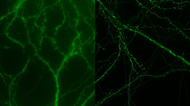 Mouse cortical neurons. Transgenic GFP (green). Image courtesy of Prof. Hui Guo, School of Life Sciences, Central South University, China 