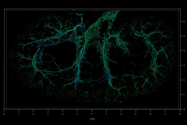 LAS X NavigatorおよびTauContrastでイメージングした腎臓切片(SunJin Labs、RapidClearで透明化処理)。 10 x 7 mmおよび500 µm厚の全体スライス。 青色のより短い光子到達時間はコラーゲン（SHGシグナル）を表し、緑色のより長い値は、Alexa 633 で染色された神経細胞を表す。