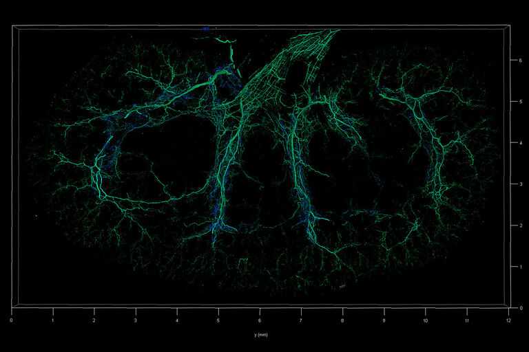 Nierenabschnitt (SunJin Labs, gecleart mit RapidClear) abgebildet mit LAS X Navigator und TauContrast. Eine ganze Scheibe von 10 x 7 mm mit einer Stärke von 500 µm. Kürzere Ankunftszeiten in Blau stehen für Kollagen (SHG-Signal), während längere Werte in Grün für Nervenzellen stehen, die mit Alexa 633 gefärbt sind.