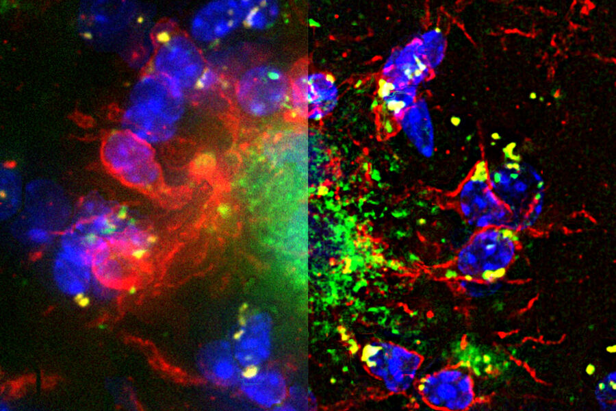 Hippocampus showing an amyloid plaque - THUNDER Imager 3D Cell Culture