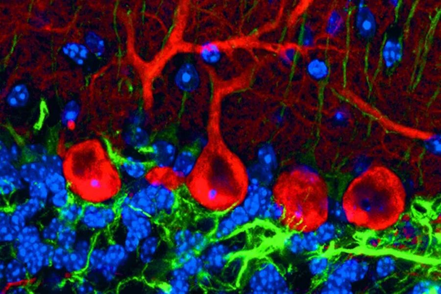 Purkinje cell or neuron in a triple labeled parasagittal section of a mouse cerebellar cortex. In the image, red indicates calbindin-D28k calcium-binding proteins (anti-calbindin-D28k/Cy3), green glial fibrillary acidic proteins (GFAP) [anti-GFAP/Cy5], and blue nuclei (Hoechst 33258).