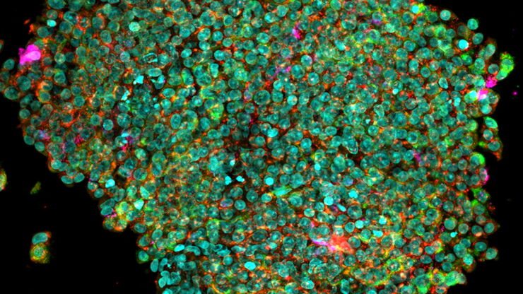 Extended depth of field reconstruction image of a whole human pancreas islet showing fluorescence signals from insulin (green), glucagon (red), an IL17 cytokine (magenta), and nuclei (blue).