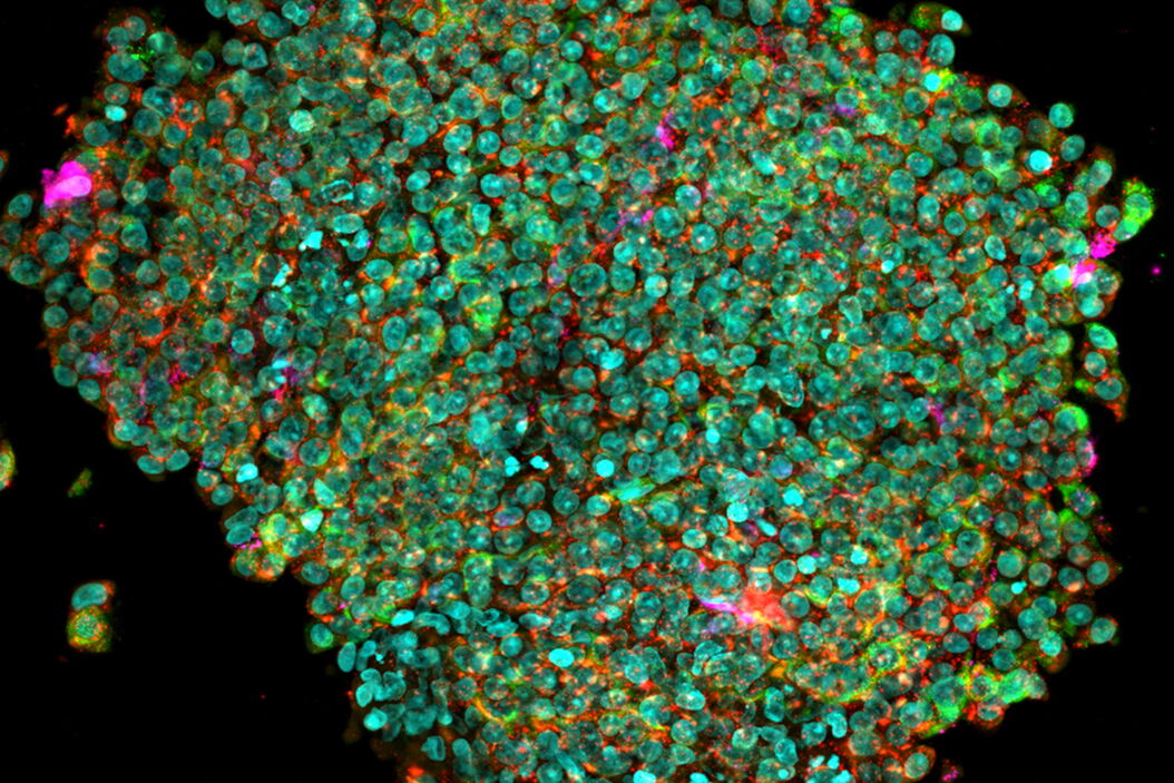 Extended depth of field reconstruction image of a whole human pancreas islet showing fluorescence signals from insulin (green), glucagon (red), an IL17 cytokine (magenta), and nuclei (blue). Whole_human_pancreas_islet_EDoF.jpg