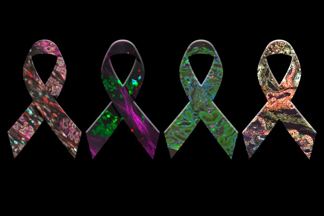  Awareness_Ribbons_Cancer_Research_ebook.jpg