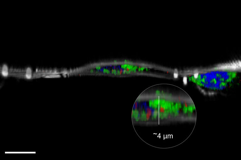 Hoechstを表示するHeLa-細胞 (青、細胞核)、Mitotracker Green (緑、ミトコンドリア)、Bodipy (赤、脂肪滴)、beads (マゼンタ、1 µm)、Reflection (白)。スケールバー 10 μm：細胞提供：Ievgeniia Zagoriy、Mahamid Group、EMBL Heidelberg（ドイツ）