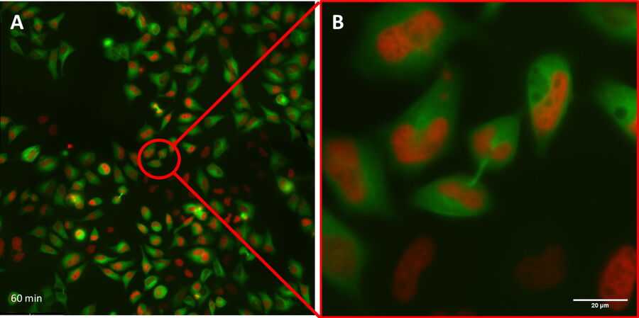 HeLa Kyoto HKF1 cells expressing H2B-mCherry (nuclei in red) and alpha tubuline-mGFP (cytosol in green)