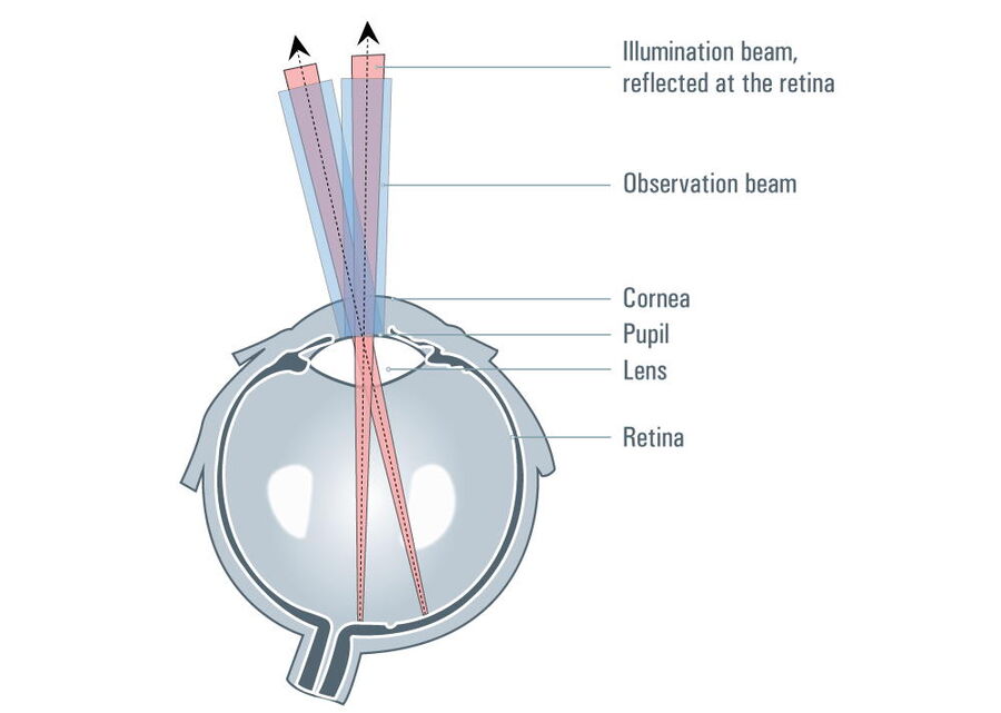 CoAx4 Illumination provides a stable and consistent red reflex