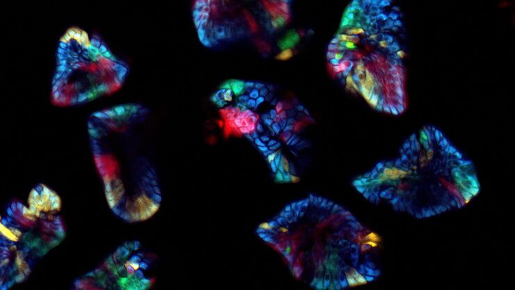 „Confetti-Mouse“, taken with the 4Tune spectral detector of Leica’s Deep in-vivo Explorer SP8 DIVE. „Confetti-Mouse“, taken with the 4Tune spectral detector of Leica’s Deep in-vivo Explorer SP8 DIVE.