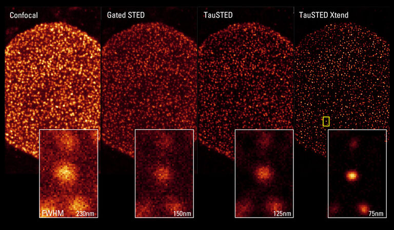 [Translate to french:] TauSTED Xtend reveals the distribution of nuclear pores (NPCs) on COS7 cells immunostained for NUP complexes with AF 488.  Only 0.5% of STED light reveals much more detail. 