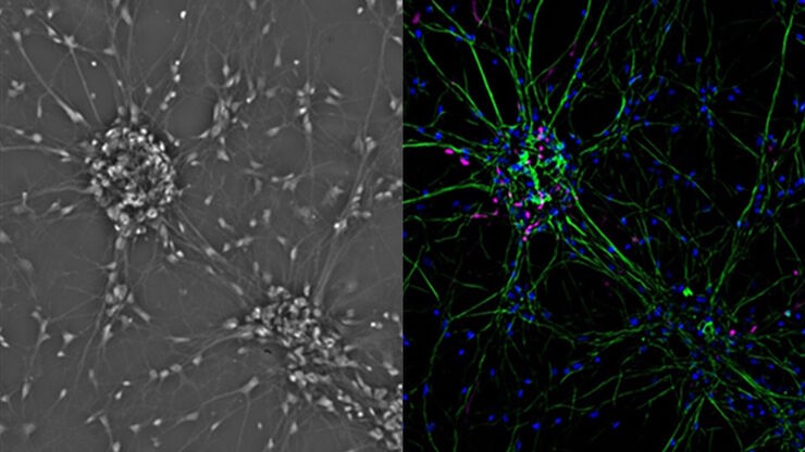 Mammalian cell culure. Phase contrast and fluorescence image.