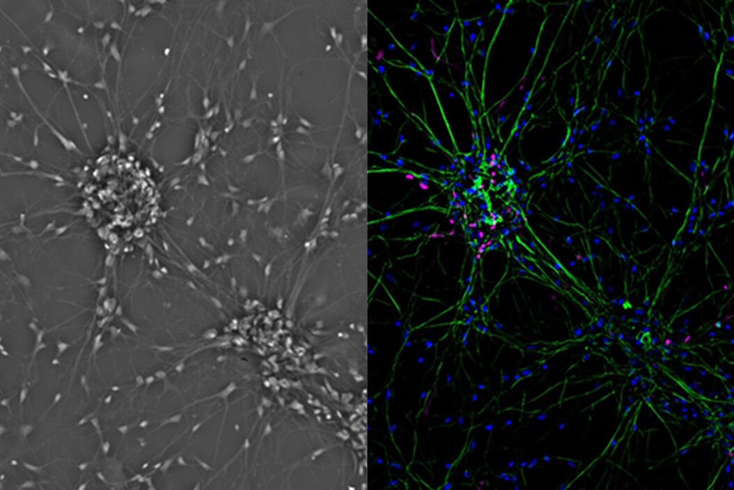 [Translate to chinese:] Mammalian cell culure. Phase contrast and fluorescence image. Mammalian_cells_culture_teaser.jpg