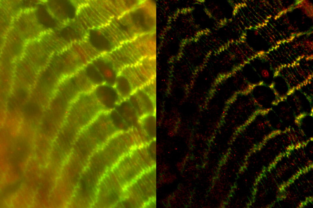 Raw widefield and THUNDER image of transversal mouse adult fiber lens section. Courtesy N. Houssin, Plagemen lab, Ohio State University, Columbus, USA. Transversal_mouse_adult_fiber_lens_section_Widefield_THUNDER_teaser.jpg