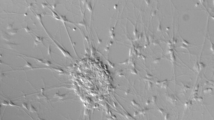 Neurons imaged with DIC contrast.