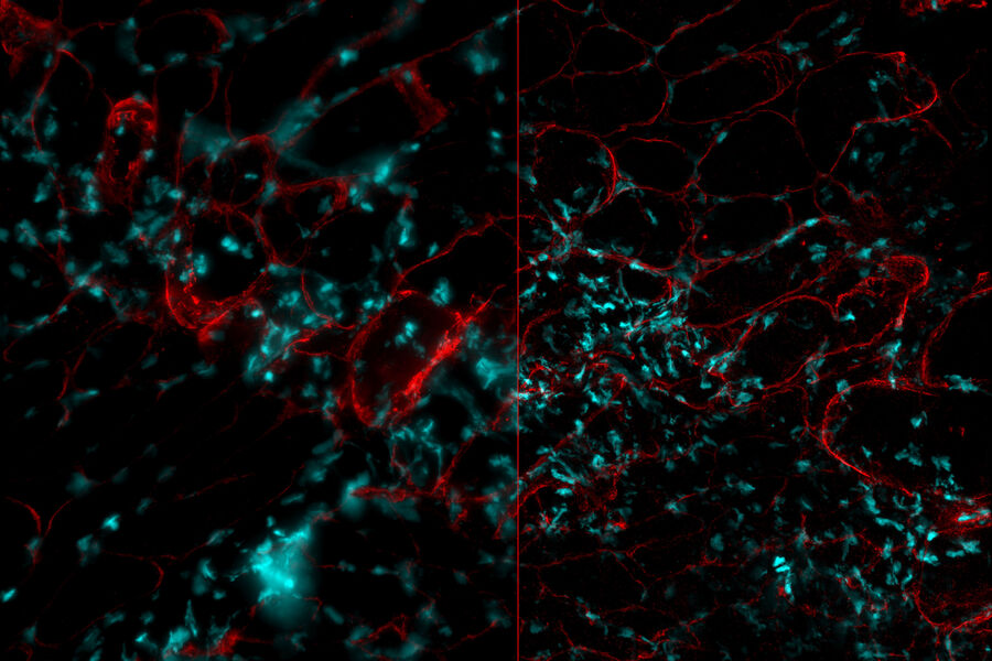 Mouse muscle tissue Top down view of mouse muscle tissue (total area: 0.56 mm2), illustrating the difference between the raw data and the data after THUNDER LVCC processing.