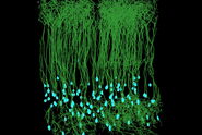 Aivia_Neuroscience-VBE comparison mouse-1_traced_ROI