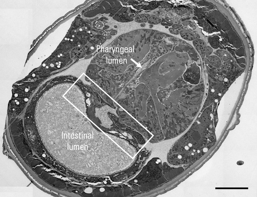 TEM image of a section of the C. elegans after automatic trimming. The pharyngeal-intestinal valve is marked by the white box. Scale bar: 10 µm. Image kindly provided by Felix Gaedke, CECAD, Cologne, Germany. 