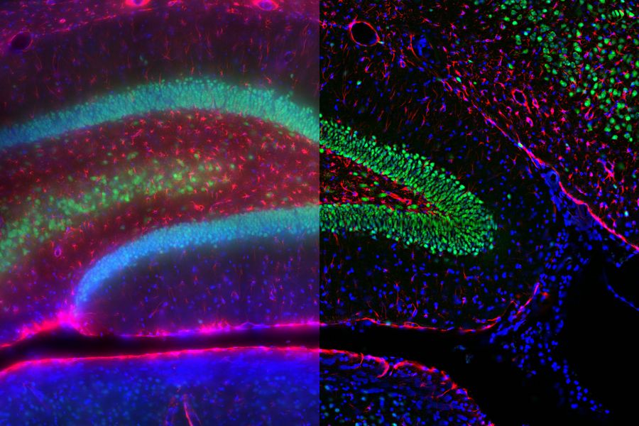 Adult rat brain where neurons appear green (Alexa Fluor488), astrocytes red (GFAP), and nuclei blue (DAPI). Image courtesy of E. Xu, Institute of Neurosciences, Department of Neurology, Second Affiliated Hospital, Guangzhou Medical University, China. Adult rat brain where neurons appear green (Alexa Fluor488), astrocytes red (GFAP), and nuclei blue (DAPI). Image courtesy of E. Xu, Institute of Neurosciences, Department of Neurology, Second Affiliated Hospital, Guangzhou Medical University, China.