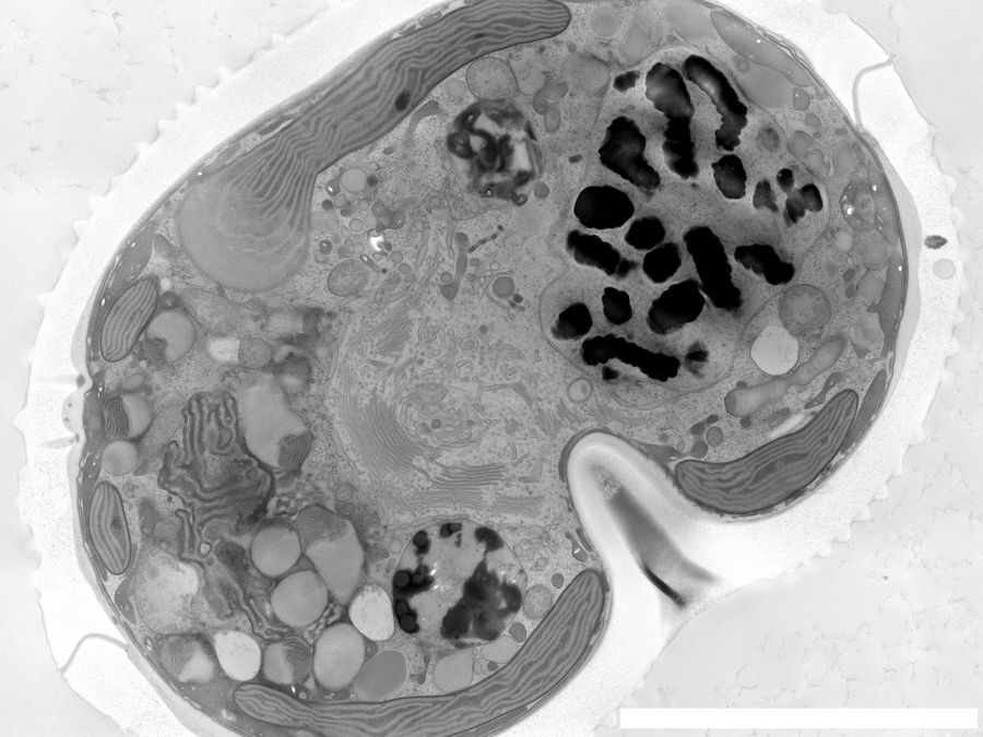 A dinoflagellate-plankton specimen prepared with HPF and imaged with EM. The scale bar is 5 μm.