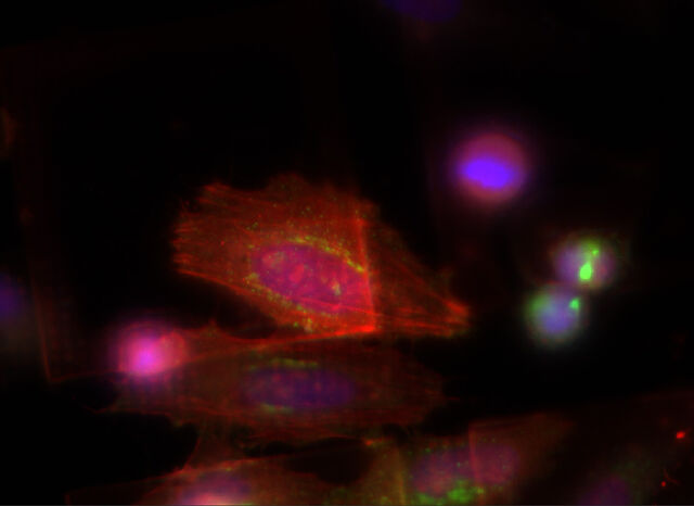 Cellule HeLa senza THUNDER Imager Cellule HeLa senza THUNDER Imager