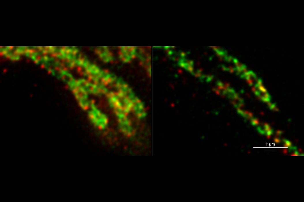  Visualization_of_submitochondrial_protein_distributions_teaser.jpg