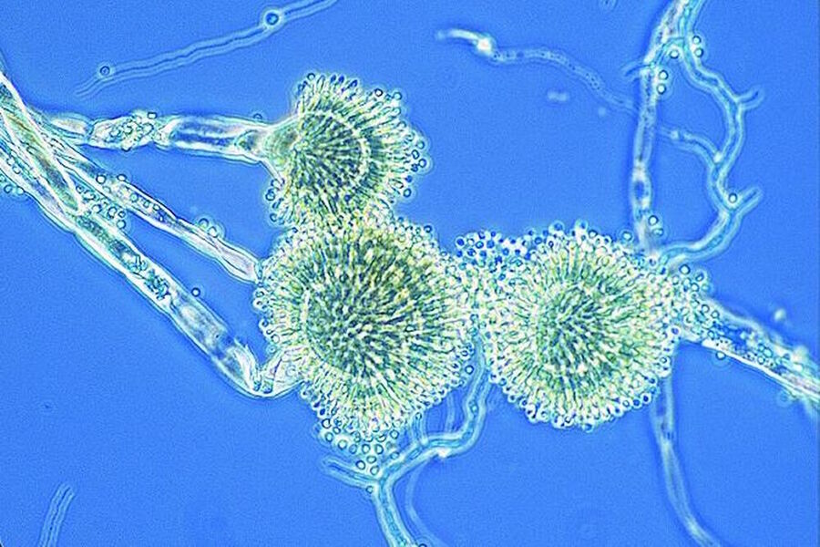 Phase-contrast image of Aspergillus mold.