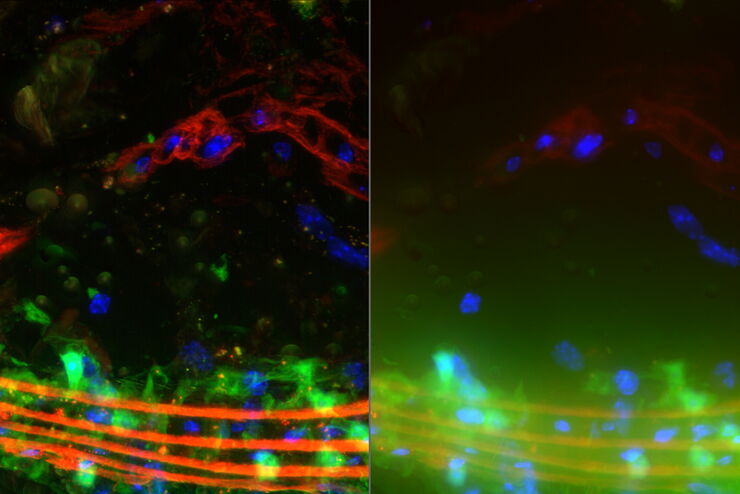 Raw widefield and THUNDER image of a mouse aorta