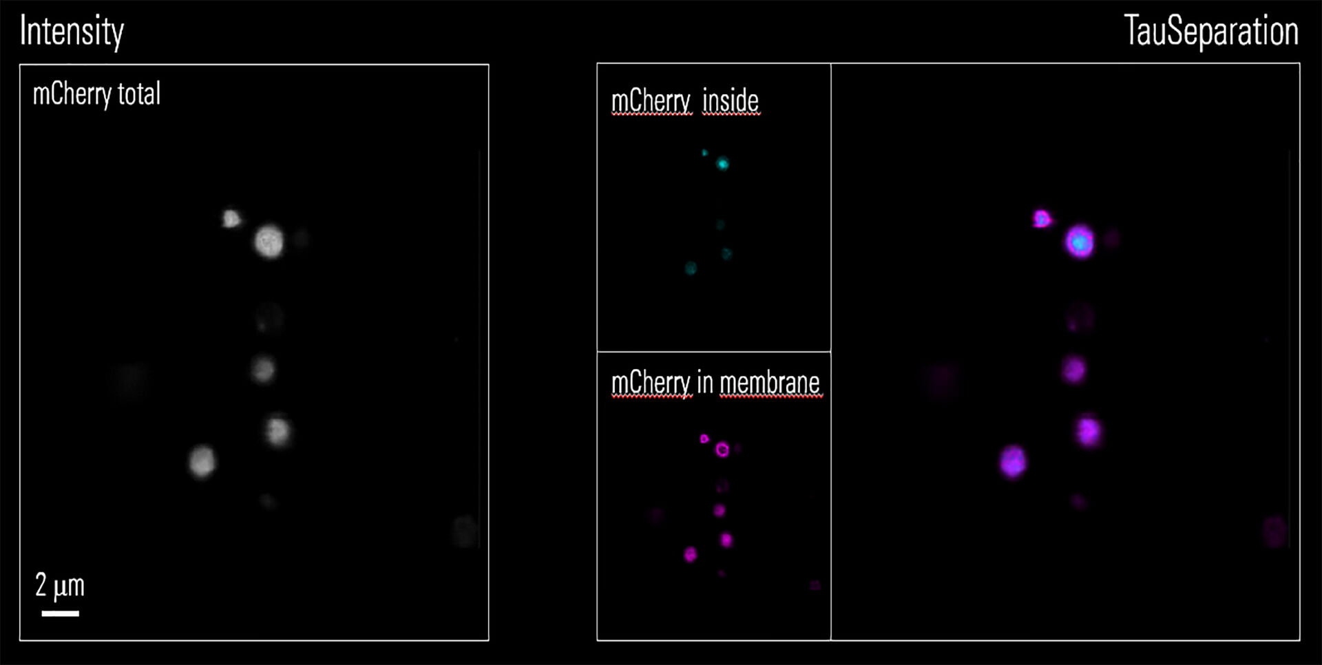 Image acquired with STELLARIS 5. Kita mycelia with mCherry expressed at the membrane and in the interior of the bacteria. Each compartment can be separated using lifetime-based information, because the microenvironment changes mCherry lifetime properties. Sample courtesy: Shraddha Shitut, Insitute of Biology, Leiden University.