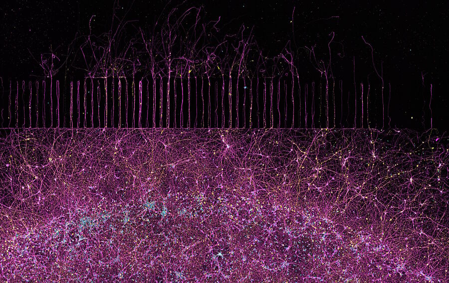Cortical neurons cultured in microfluidic chamber for 10 days. Fixation with PFA 4%. Immunofluorescence Tubulin alpha (green), Tau (red), DAPI (blue). Image courtesy of Wei Wang, USA.