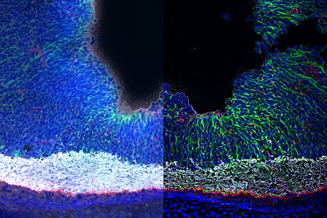 Mouse kidney section with Alexa Fluor™ 488 WGA, Alexa Fluor™ 568 Phalloidin, and DAPI. Sample is a FluoCells™ prepared slide #3 from Thermo Fisher Scientific, Waltham, MA, USA. Images courtesy of Dr. Reyna Martinez – De Luna, Upstate Medical University, Department of Ophthalmology. The_Power_of_Pairing_Adaptive_Deconvolution_teaser.jpg