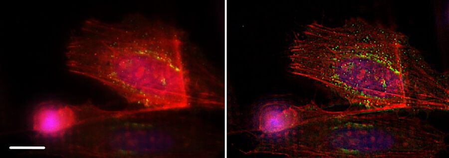 HeLa-cells with F-actin stain (mcherry), Trans-Golgi Network protein TGN46 (GFP), and DNA (Hoechst 33342) before (left) and after (right) applying THUNDER SVCC. Sample courtesy of Dr. Marie-Charlotte Domart & Dr. Lucy Collinson, The Francis Crick Institute, London, UK.