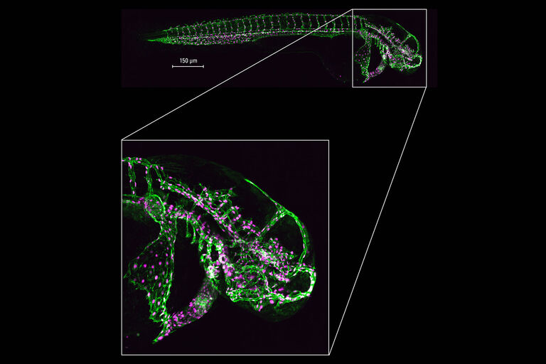 Hochauflösende Bildgebung großer ganzer Proben: Die Mosaikscan-Option ermöglicht die vollständige Bildgebung großer Proben, wie dem gesamten hier gezeigten Zebrafischembryonen, in hoher Auflösung. Mit freundlicher Genehmigung von Elvire Guiot, IGBMC Imaging Center, Illkirch-Graffenstaden, Frankreich, und Julien Vermot, Imperial College London, Großbritannien.
