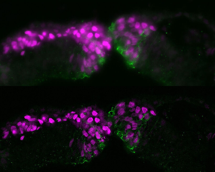 The image was taken with a THUNDER Imager 3D Cell Culture using a 1.3 NA 40x plan apo oil objective. The upper image is the raw widefield data. The lower image the result after the Leica proprietary Small Volume Computational Clearing (SVCC) has been applied to remove out-of-focus blur and better reveal the underlying structure within the sample. Image courtesy of Michael Piacentino, BronnerLab, California Institute of Technology, Pasadena, CA, USA.