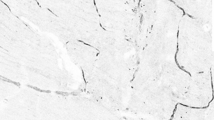 Tile scan of large intestine of an anasthesized mouse. Tile scan of large intestine of an anasthesized mouse.