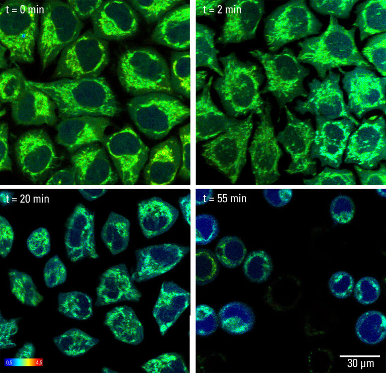 Autofluorescência em células de mamíferos em condições não fisiológicas (pH 8,5). O sinal correlaciona-se com mudanças no pool endógeno de NAD/NADH. O desenvolvimento de estresse oxidativo é interpretado como uma diminuição do tempo de vida da fluorescência ao longo do tempo. Tamanho da imagem original: 512 x 512 pixels. Escala de barra de cores (tempo de vida): ns.