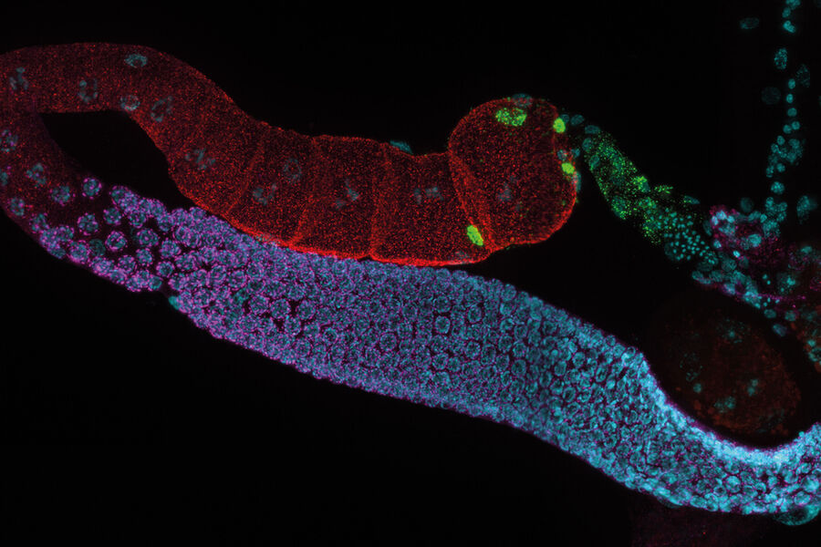 Ausgewachsene hermaphroditische Gonaden von C. elegans, aufgenommen mit THUNDER Imager. Färbung: blau - DAPI (Zellkern), grün - SP56 (Spermien), rot - RME-2 (Eizelle), magenta - PGL-1 (RNA + Proteingranula). Bild mit freundlicher Genehmigung von Prof. Dr. Christian Eckmann, Martin-Luther-Universität, Halle, Deutschland.