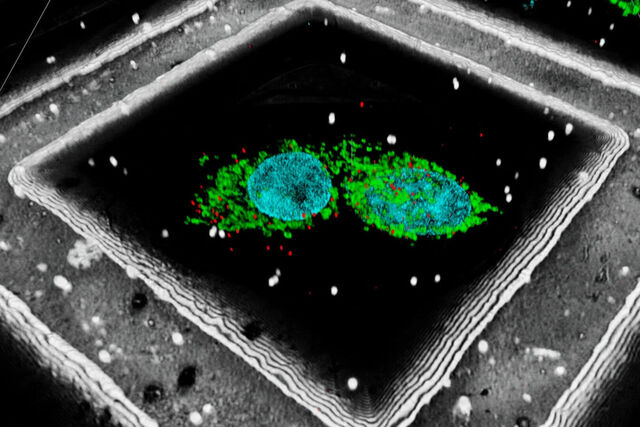 Correlative Light and Electron Microscopy (CLEM) | Applications | Leica ...