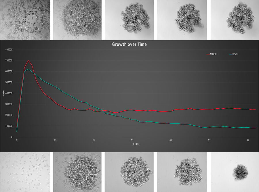 Abb. 3: Obere Reihe: Ausgewählte Bilder aus einer Zeitserie eines sich bildenden Sphäroids nach Ausplattieren von 1000 MX1-GFP-stabil transfizierten MDCK-Zellen.
