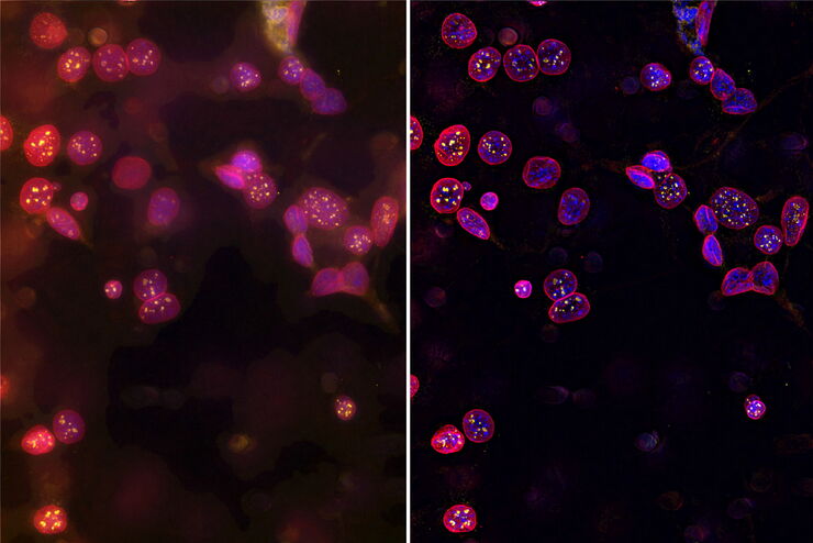Images of C2C12 cells which were stained with lamin B (magenta), Hoechst (blue), and yH2AX (yellow). A) raw widefield fluorescence image and B) THUNDER image after LVCC. The yellow foci indicate damaged DNA.