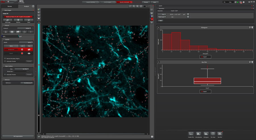 Analysis of brain slide image_Mica