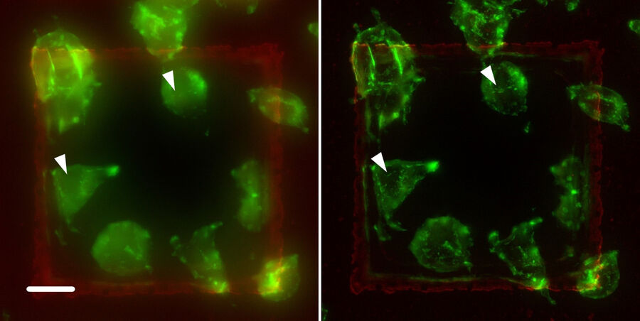 A9 cells labeled with Alexa Fluor 488 Phalloidin marking fibrous actin (F-actin). Projection of a 3D image stack before (left) and after THUNDER (right). THUNDER removes the haze and even the tiniest structures (arrows) are more clearly visible for targeting (SVCC applied).