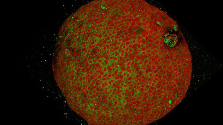 Two-color SRS image of human pancreatic organoids showing proteins (red) and lipids (green).