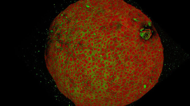 Two-color SRS image of human pancreatic organoids showing proteins (red) and lipids (green). Two-color SRS image of human pancreatic organoids showing proteins (red) and lipids (green).