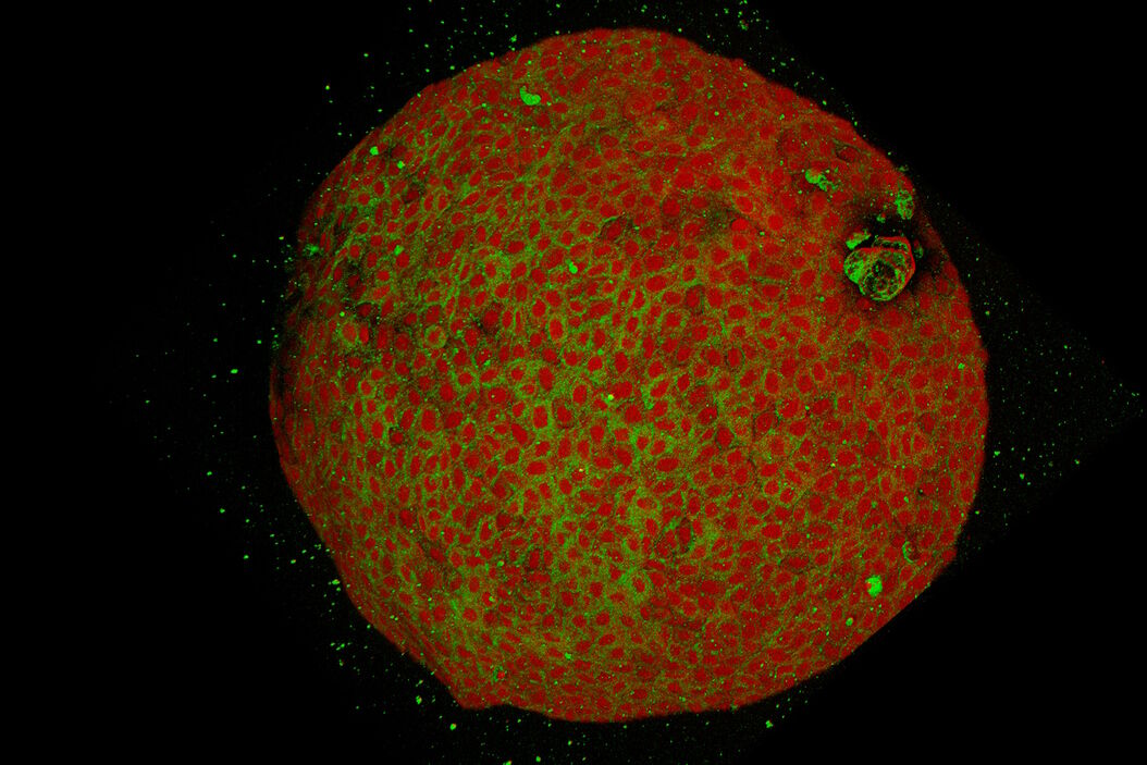 Two-color SRS image of human pancreatic organoids showing proteins (red) and lipids (green). Human_Pancreatic_Organoid_3D_CRS.jpg