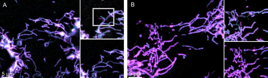 Images of U2OS cells widefield vs Mica