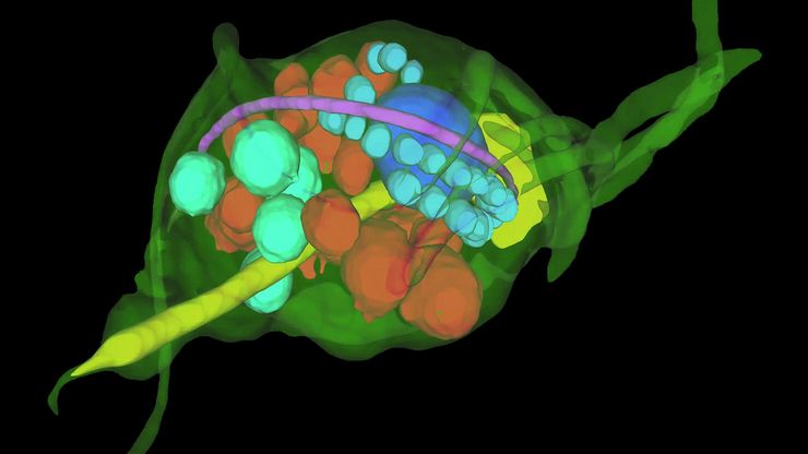 Trichomonas parasite in mouse gut, rOTO Embedding and serial sections for array tomography imaging.
