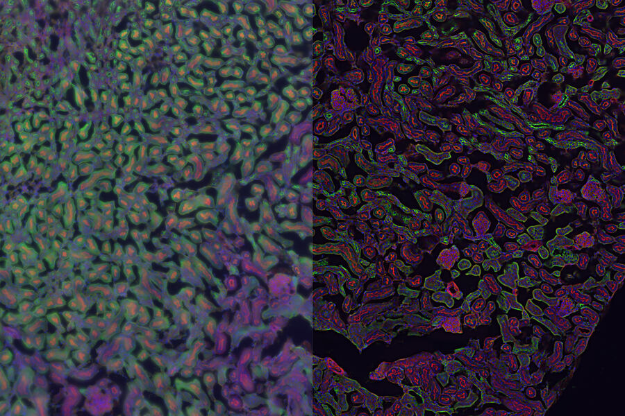 Mouse kidney section - THUNDER Imager Tissue 3D