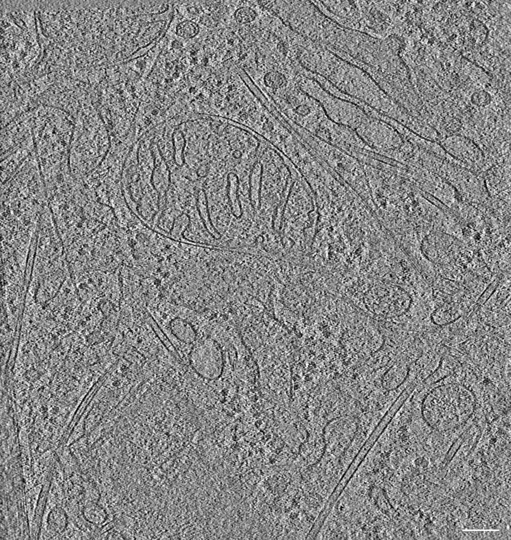 Advance Cryogenic Sample preparation techiniues for electron microscopy