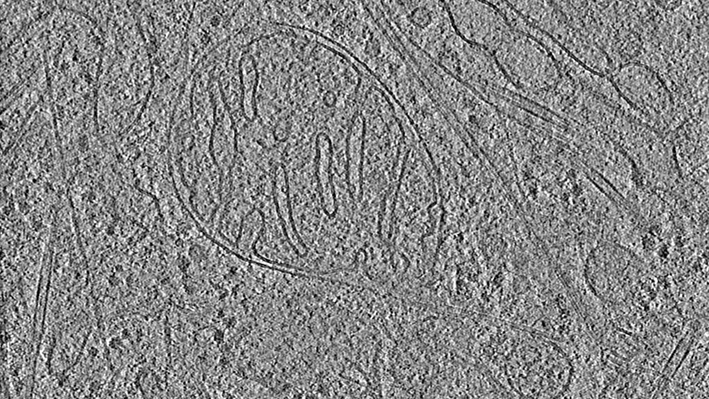 Advance Cryogenic Sample preparation techiniues for electron microscopy